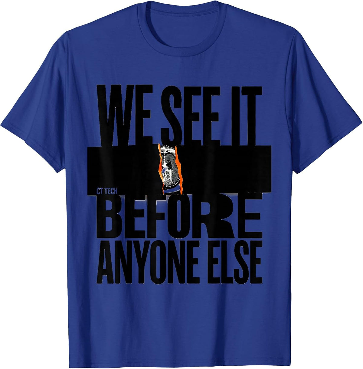 We See It Before Anyone Else CT Tech Radiology Rad Tech T-Shirt - Royal Blue