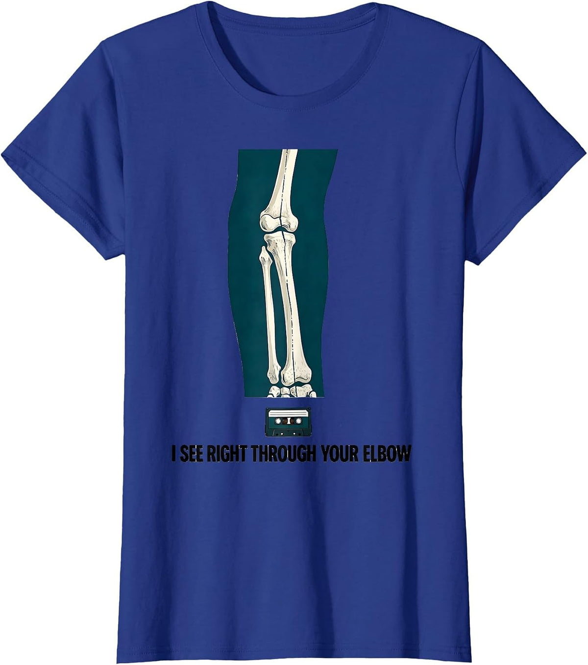 Women's I See Right Through Your Elbow Funny Radiology Tech Humor T-Shirt - Royal Blue