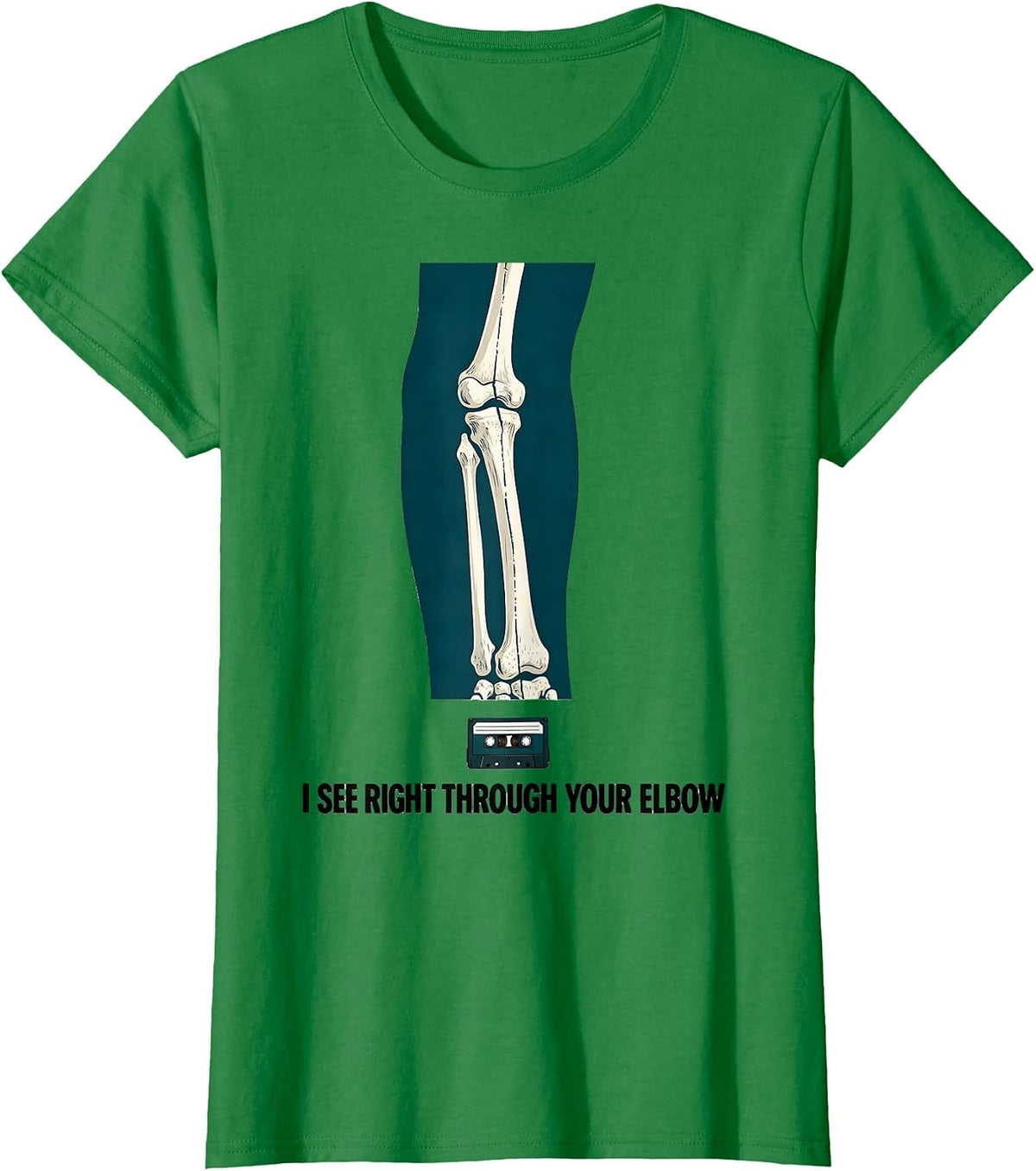 Women's I See Right Through Your Elbow Funny Radiology Tech Humor T-Shirt - Kelly Green