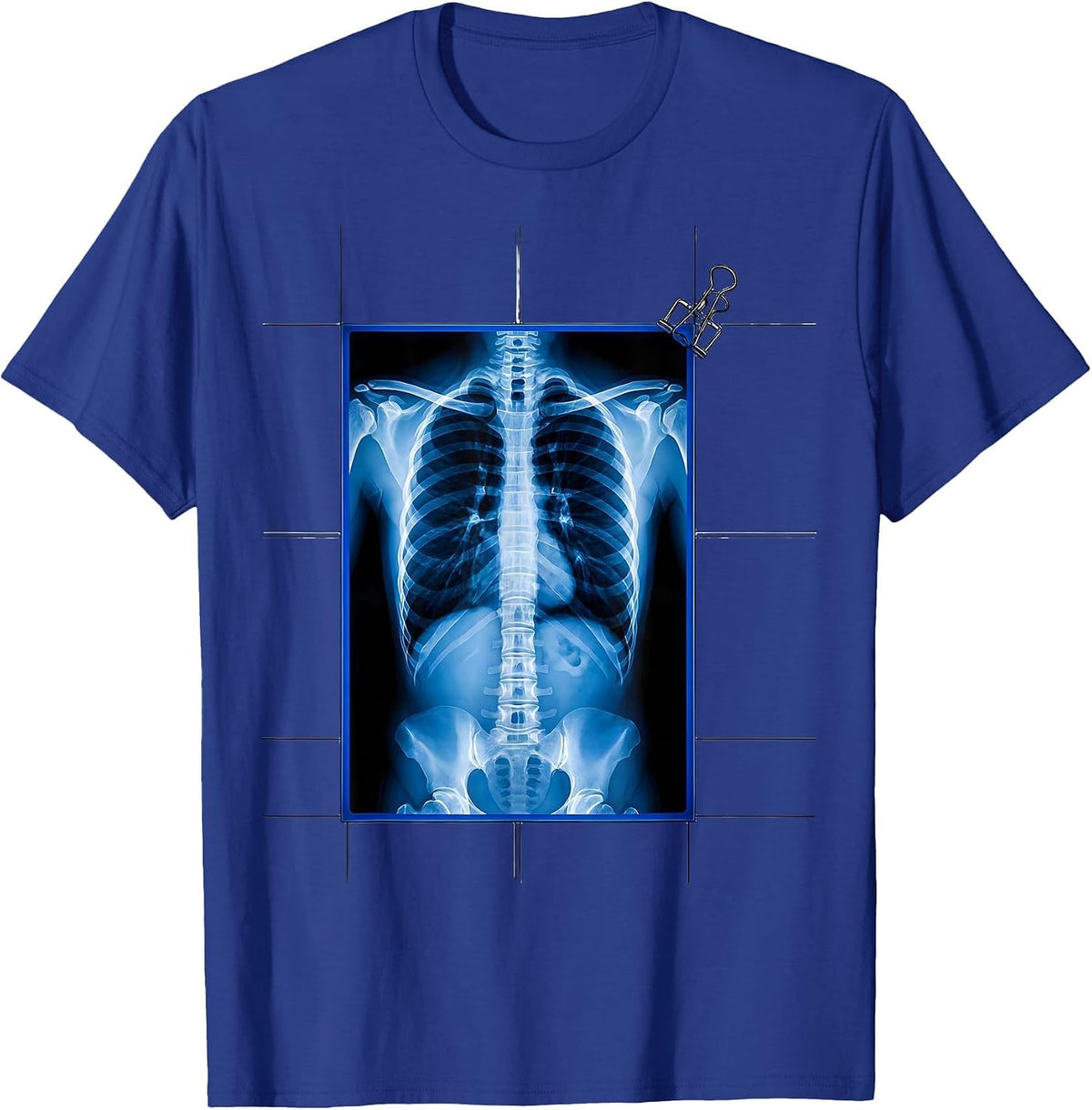 Radiographic Ribcage Swiss International Radiology Tech T-Shirt - Royal Blue